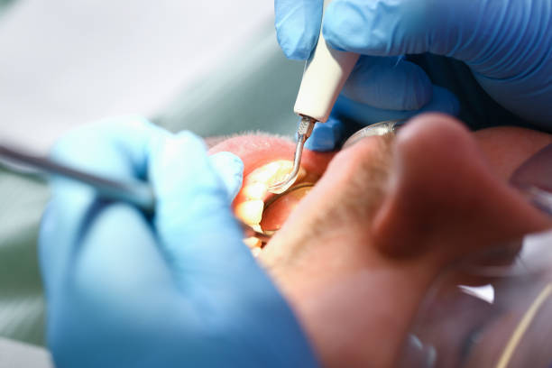Best Broken or Cracked Tooth Emergency Dentist in Homeland, GA