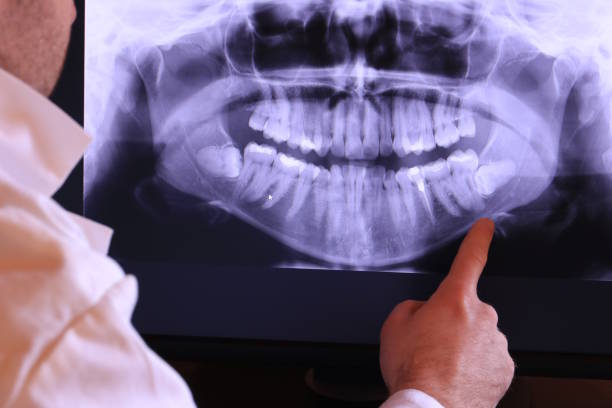 Best Emergency Dental Services for Seniors in Homeland, GA